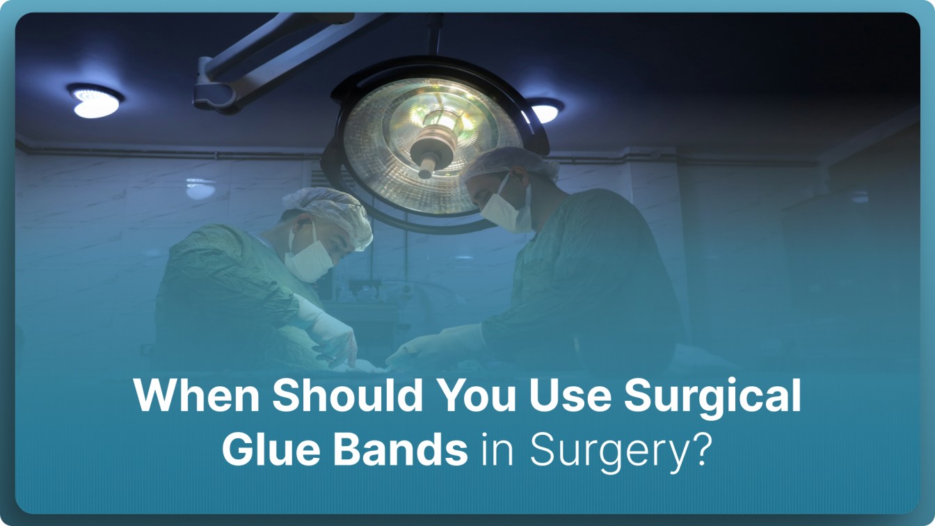 When Should You Use Surgical Glue Bands in Surgery? (2026)