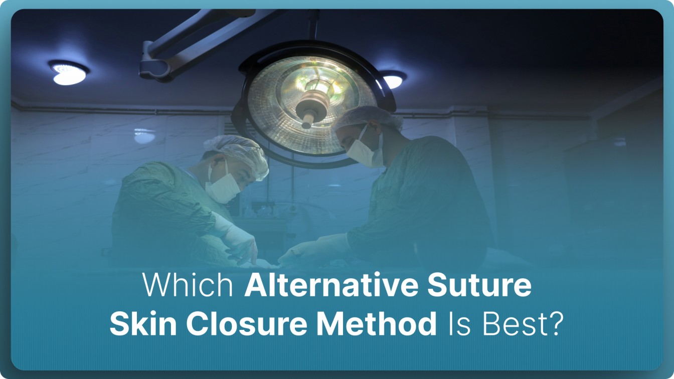 Which Alternative Suture Skin Closure Method Is Best? (2026)