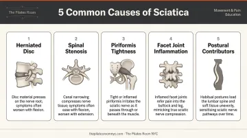 Five common causes of sciatica and lower back pain illustrated infographic