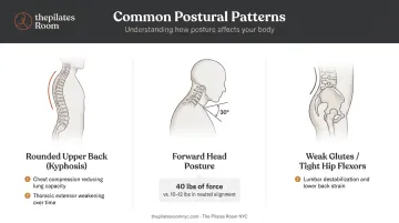 Three common posture problems and their biomechanical effects on the spine