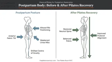 Pregnancy postural changes and Pilates postural restoration benefits side-by-side comparison