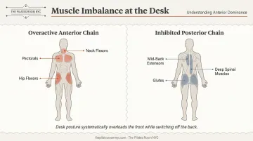 Anterior versus posterior chain muscle imbalance from prolonged desk sitting infographic