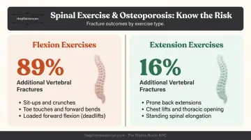 Spinal flexion versus extension fracture risk comparison statistics for osteoporosis