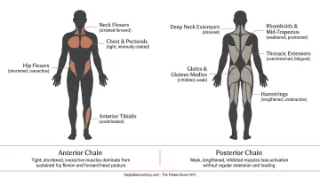 Anterior versus posterior chain muscle imbalance from prolonged desk sitting infographic