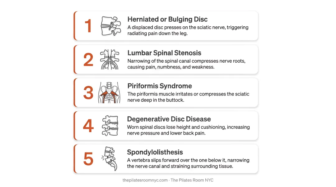 Five common causes of sciatica and lower back pain illustrated infographic