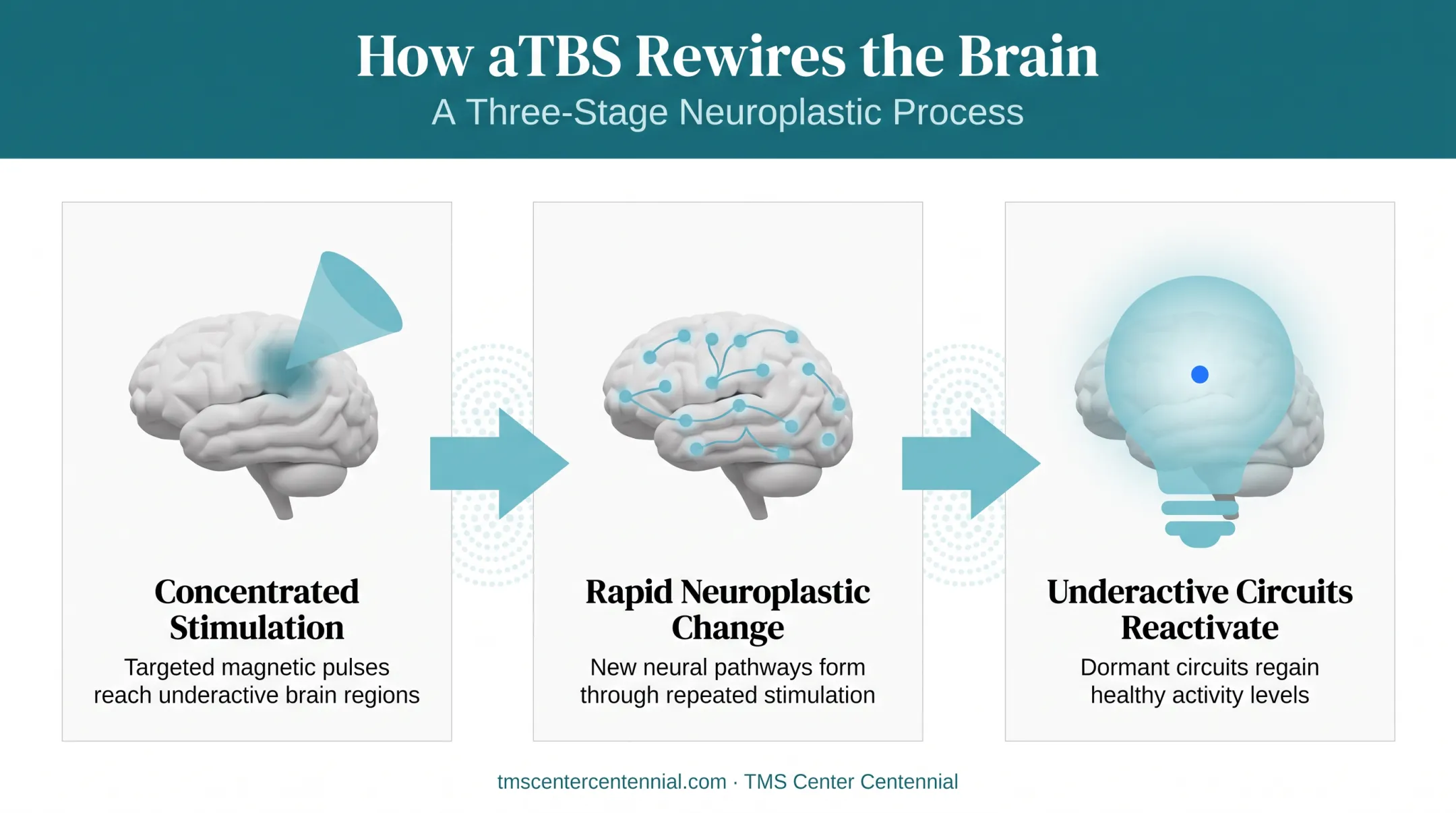 Three-step neuroplasticity process of accelerated theta burst brain stimulation