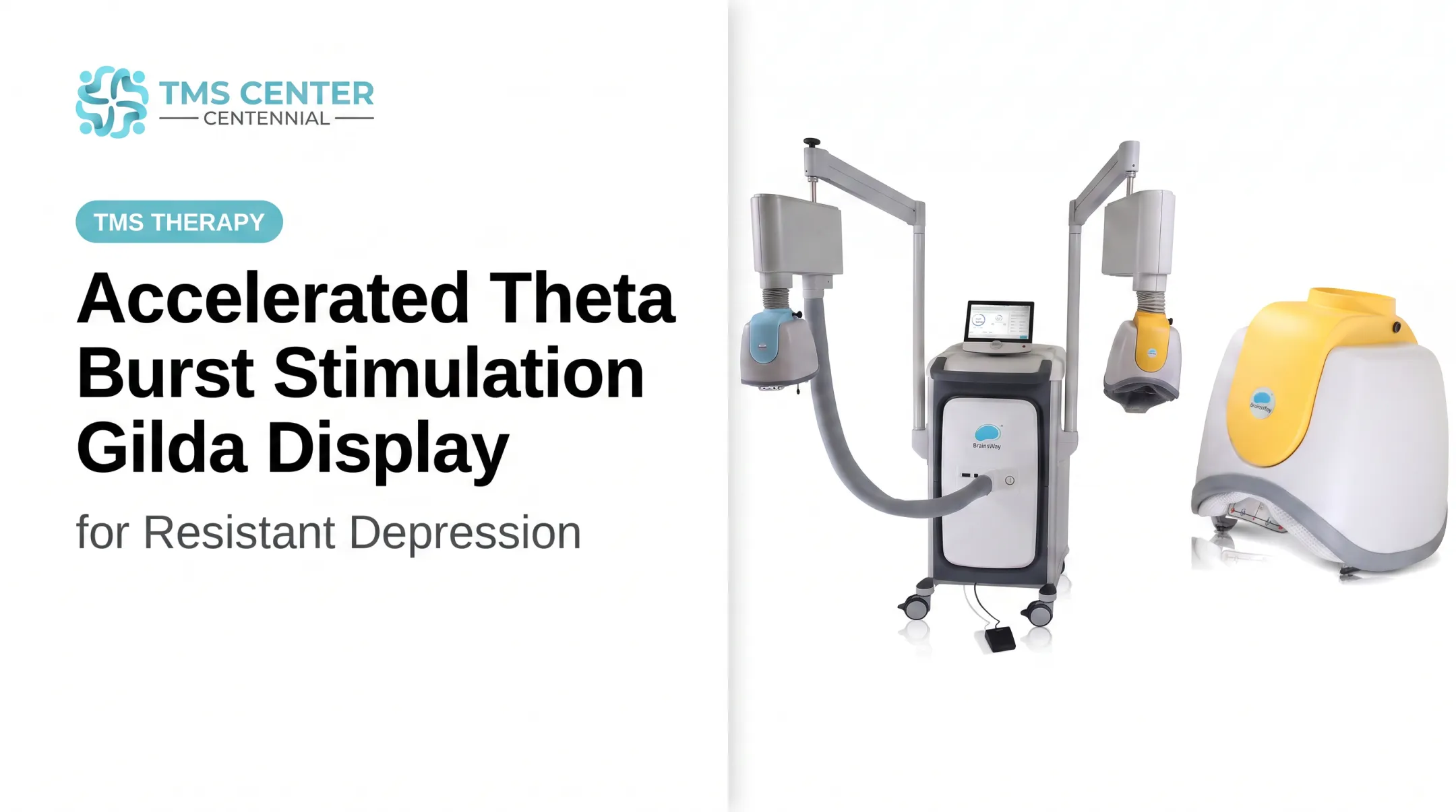 Accelerated Theta Burst Stimulation for Resistant Depression