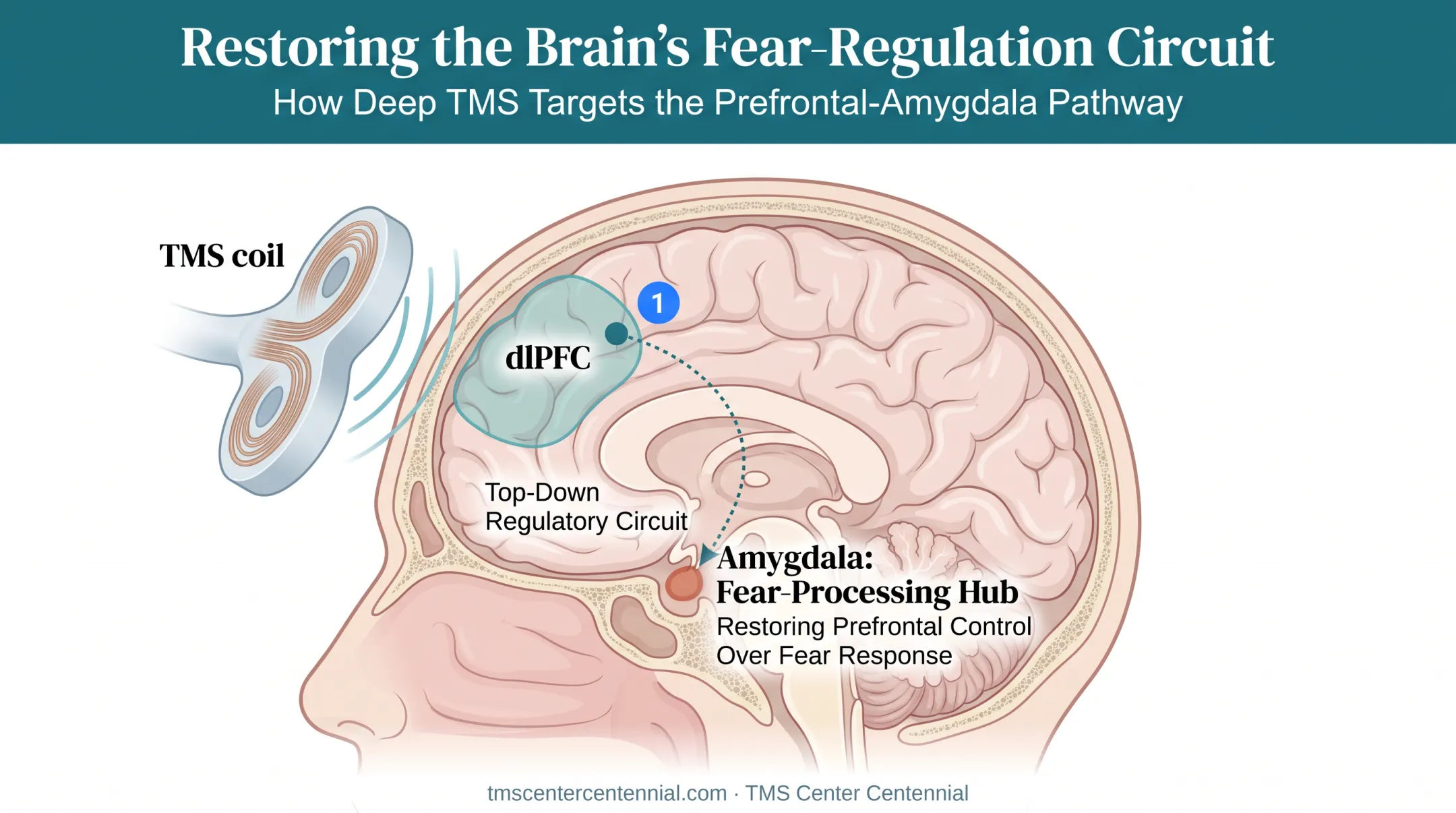 TMS brain stimulation targeting dorsolateral prefrontal cortex and amygdala connection