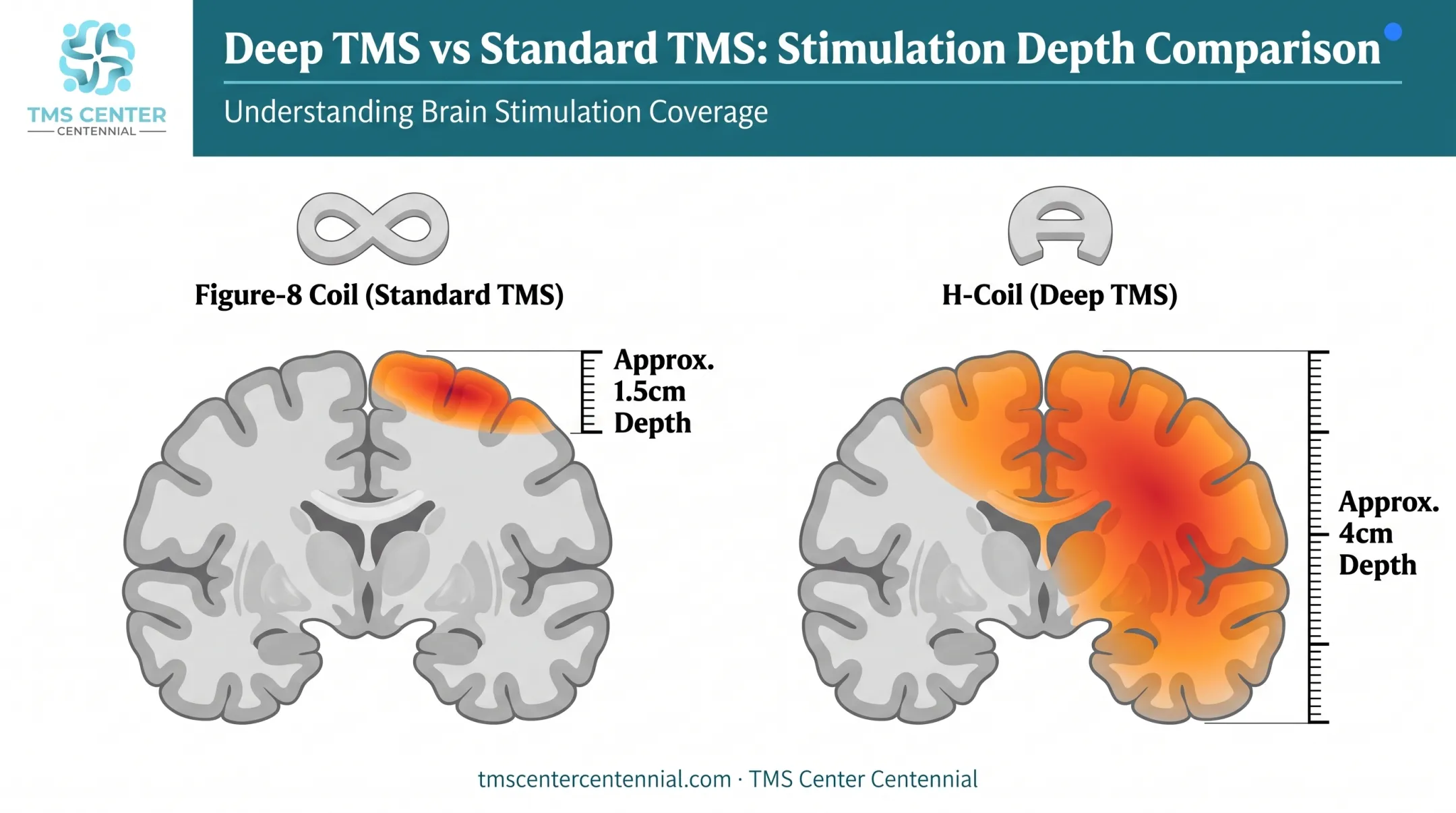 Deep TMS H-coil versus figure-8 coil brain stimulation depth comparison