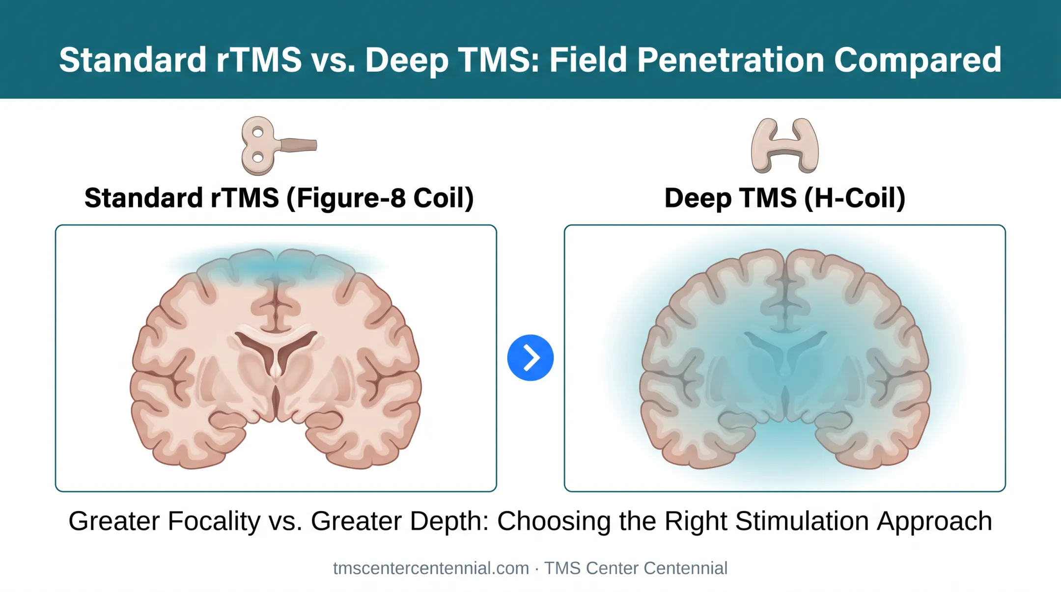 Standard rTMS figure-eight coil versus Deep TMS H-coil brain penetration