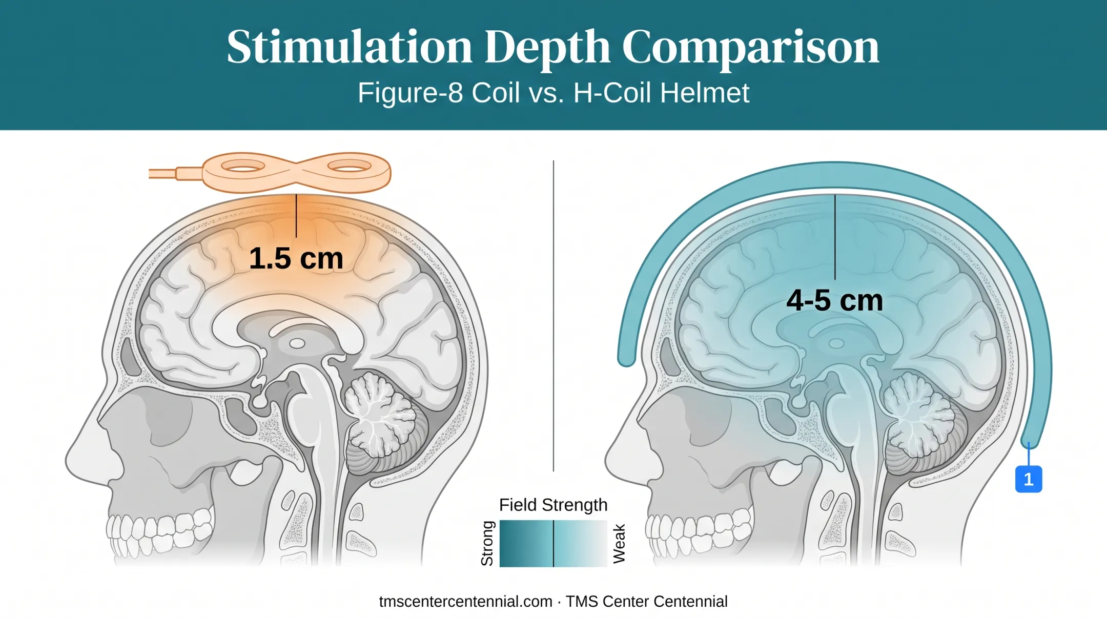 Stimulation depth comparison between figure-8 coil and H-coil brain diagram