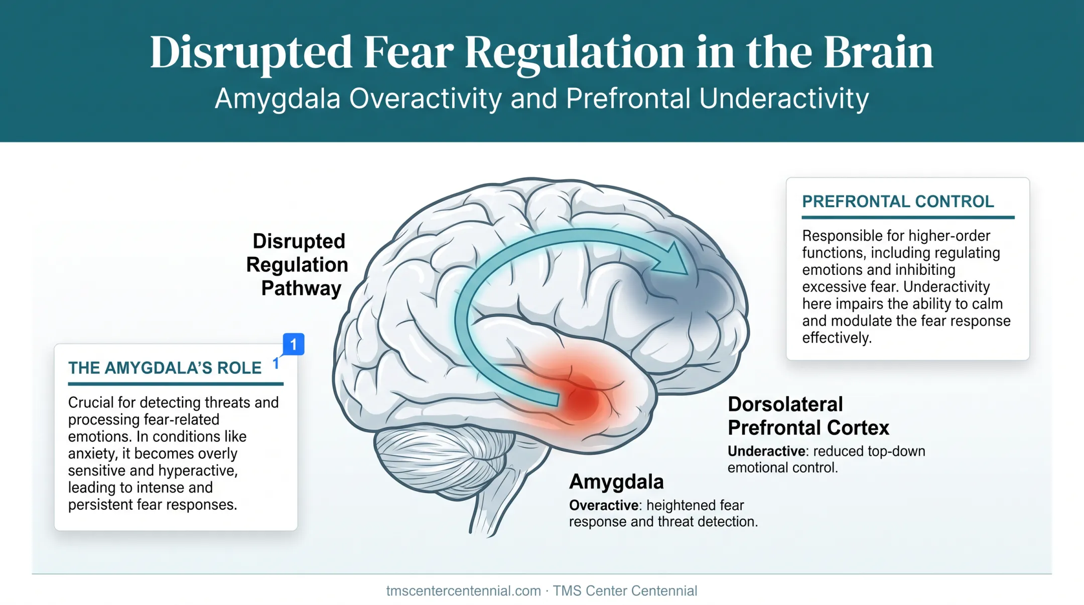 Brain diagram showing amygdala and prefrontal cortex anxiety circuit imbalance