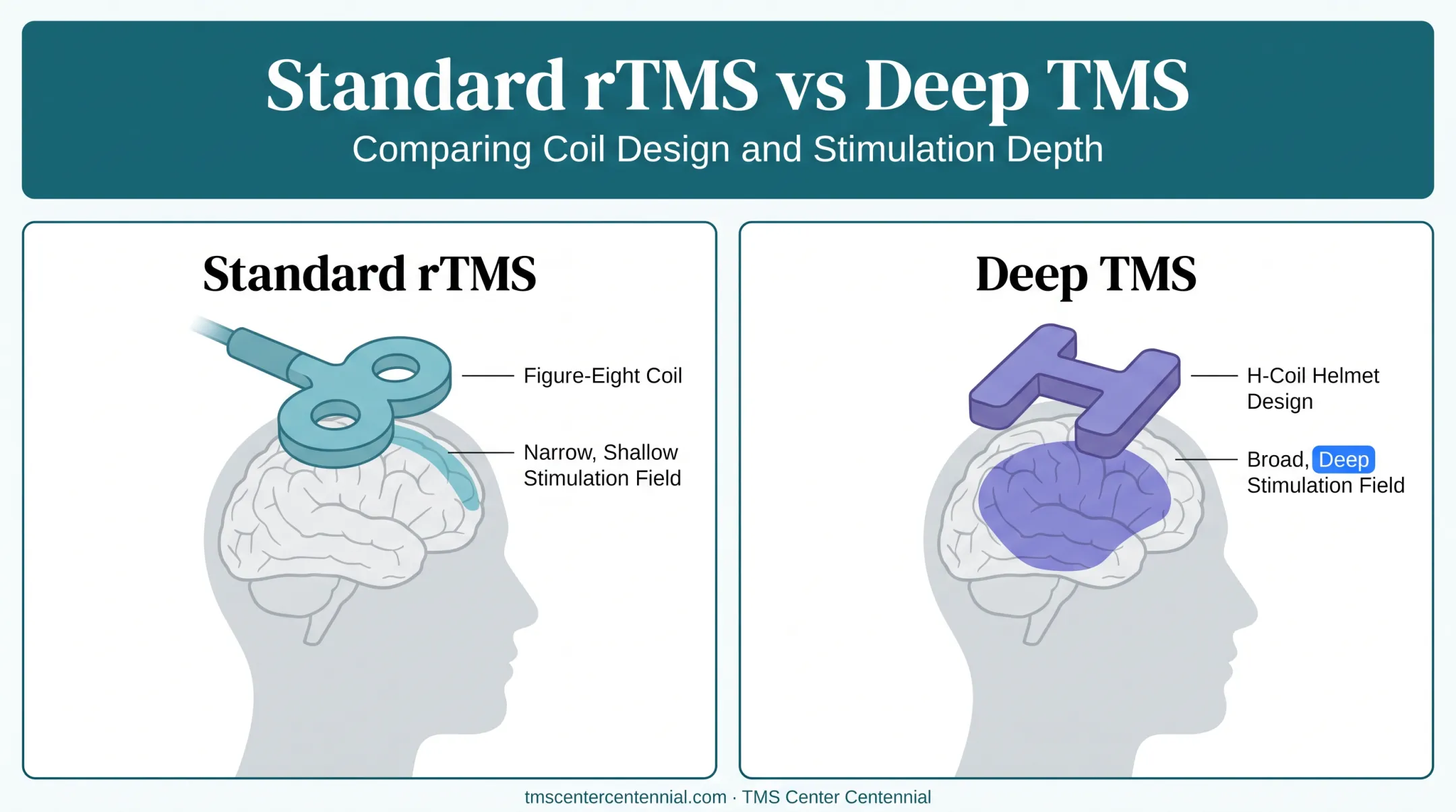 Standard rTMS versus Deep TMS coil design and brain reach comparison