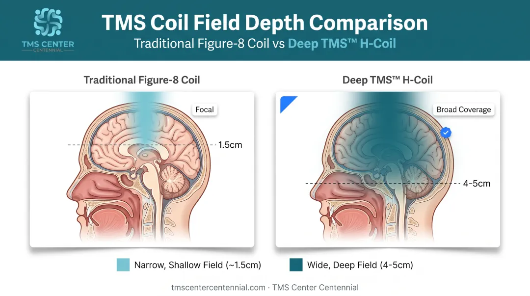 Traditional figure-8 coil versus Deep TMS H-coil field depth comparison
