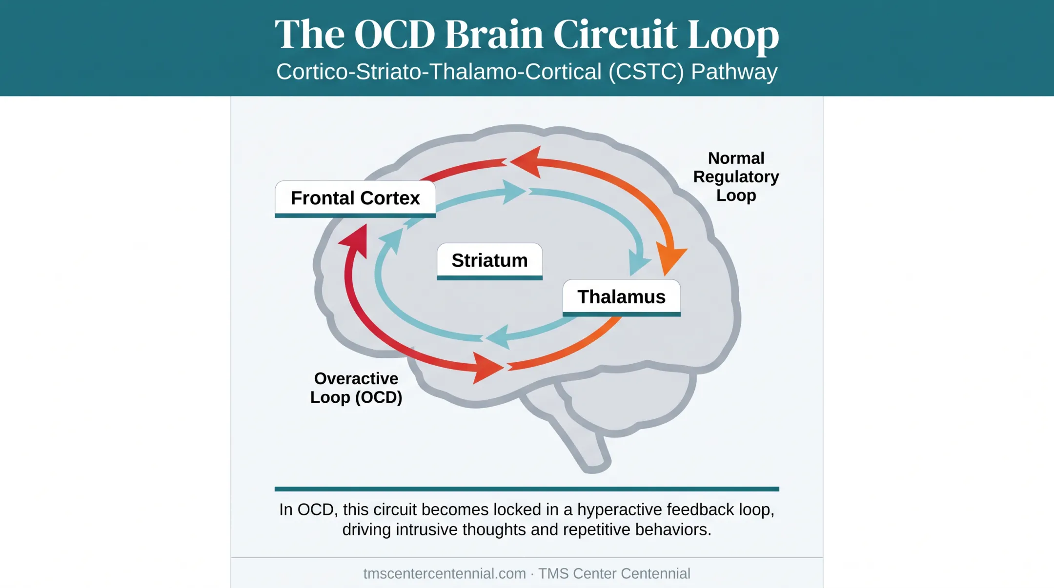 CSTC brain circuit loop diagram showing OCD dysfunction pathway