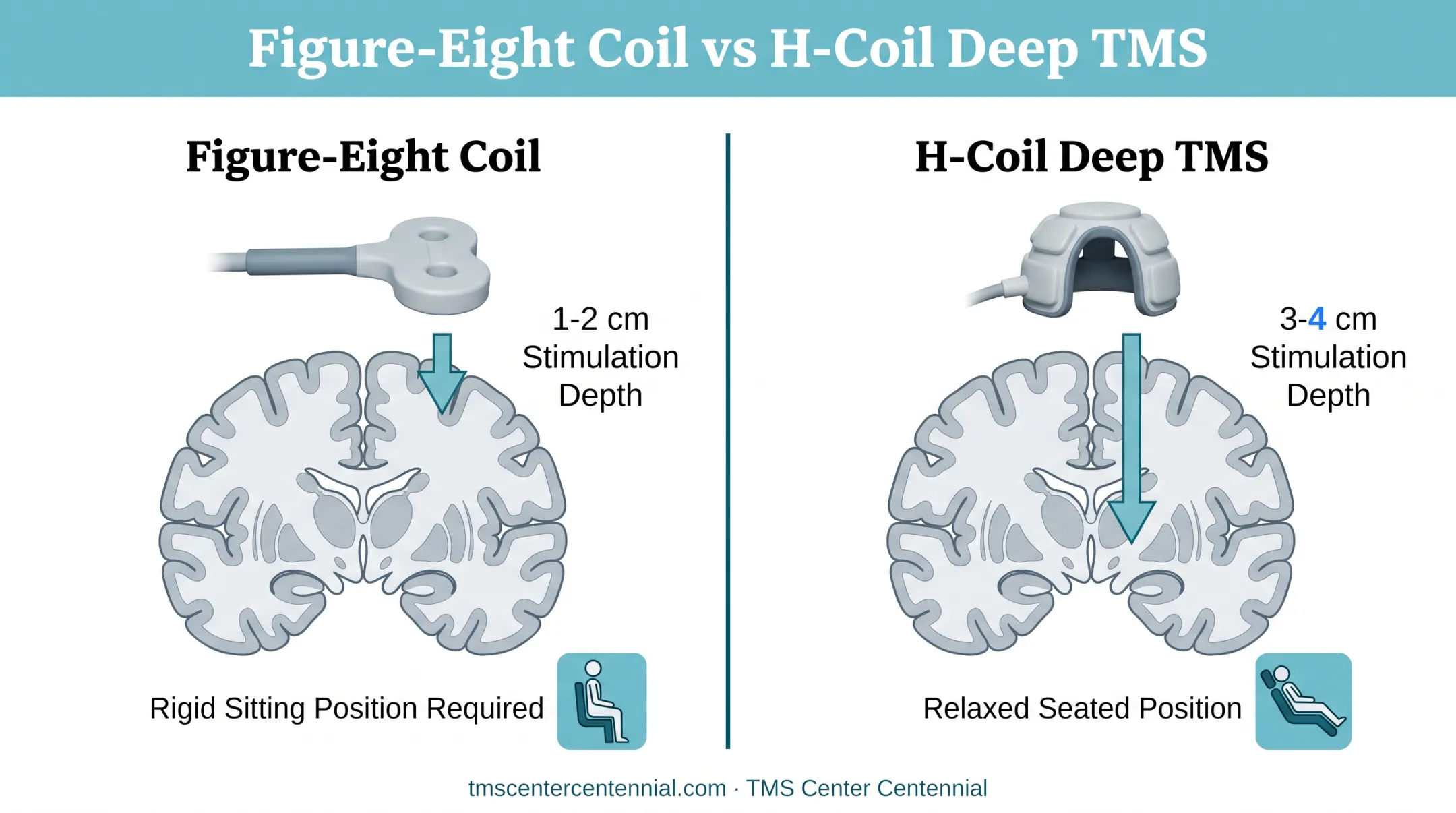 Figure-eight coil versus H-coil Deep TMS depth and design comparison