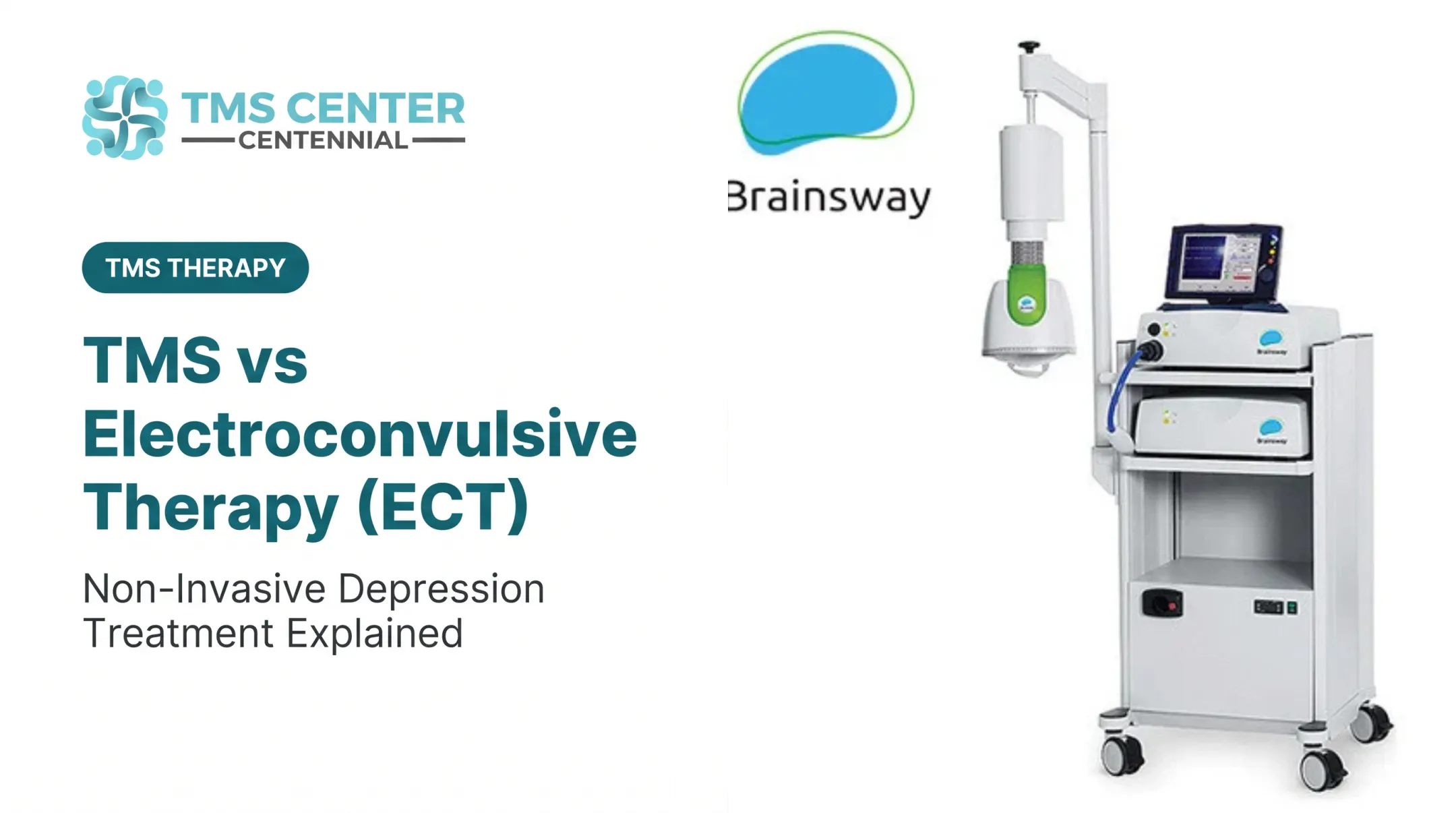 TMS vs Electroconvulsive Therapy (ECT)