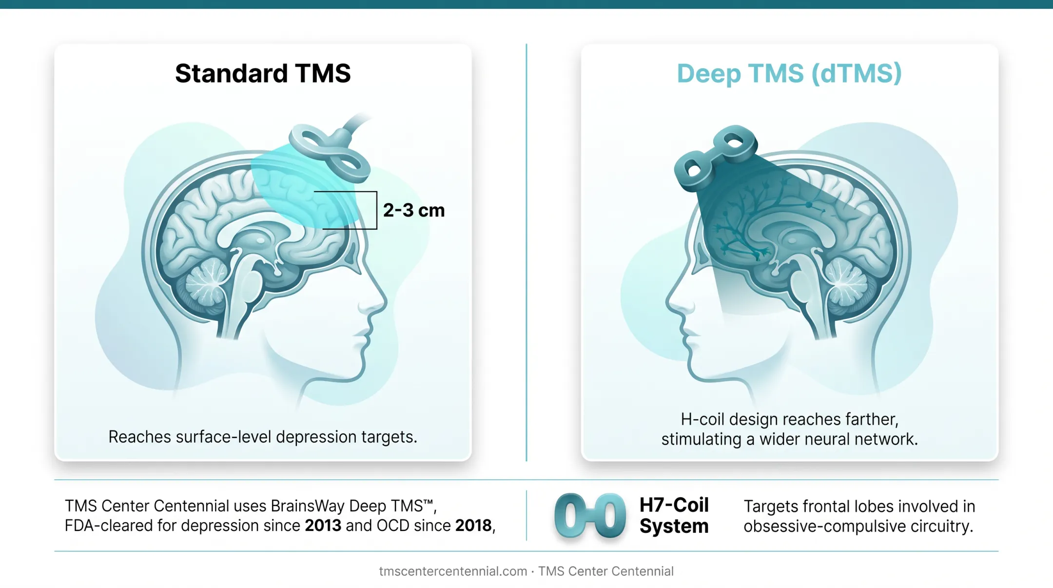 Standard TMS versus Deep TMS coil depth and coverage comparison