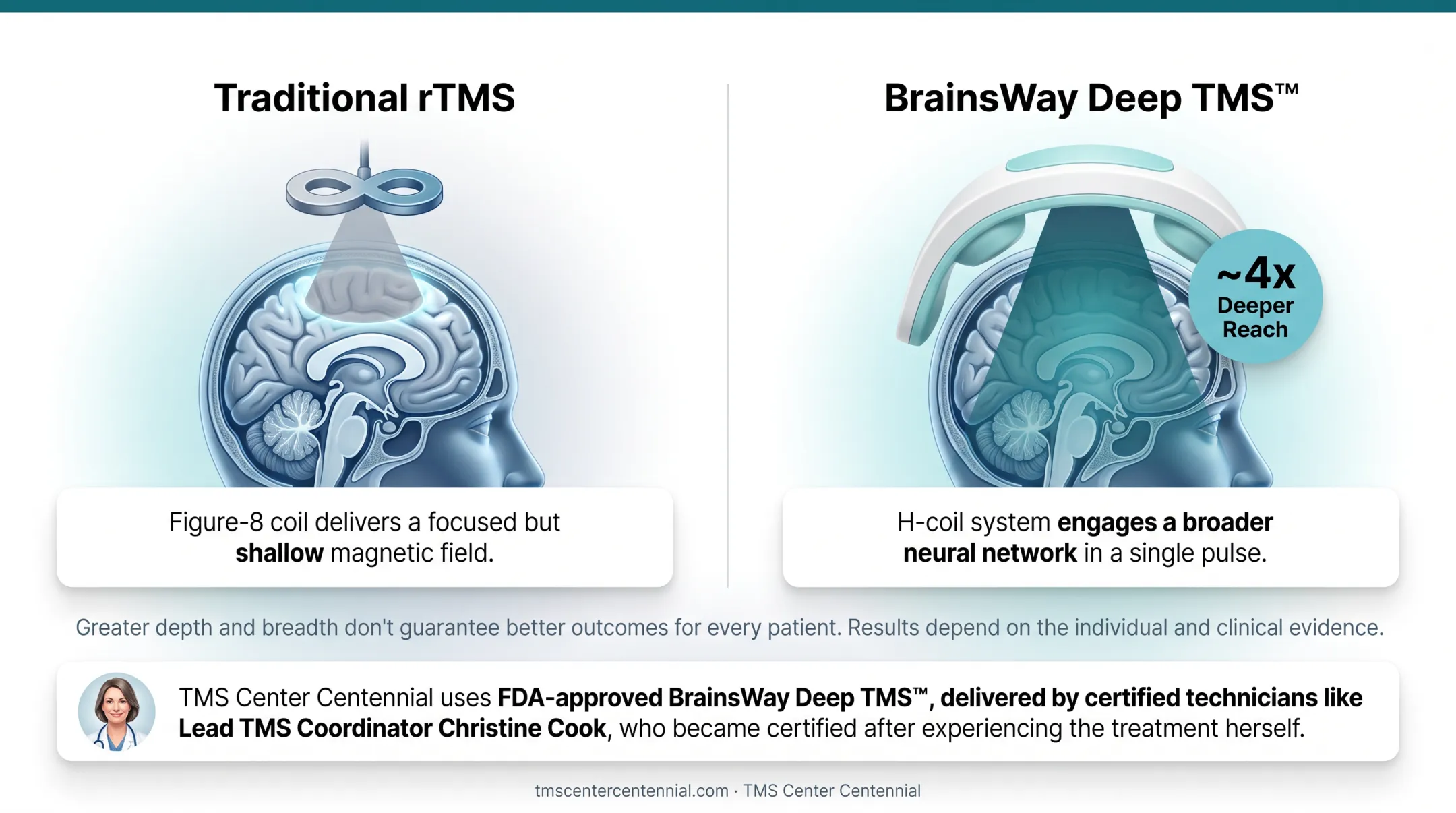 Traditional figure-8 coil versus Deep TMS H-coil field depth comparison