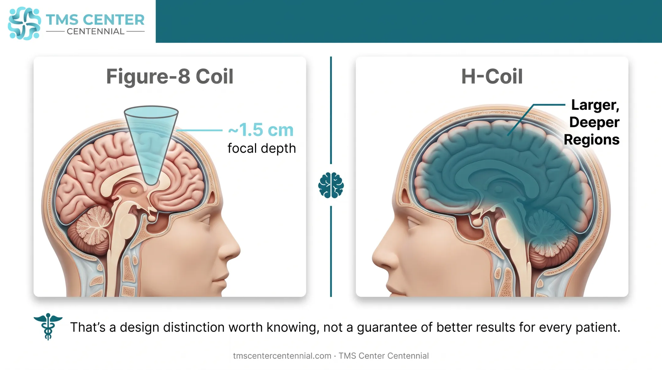 Deep TMS H-coil versus figure-8 coil brain stimulation depth comparison