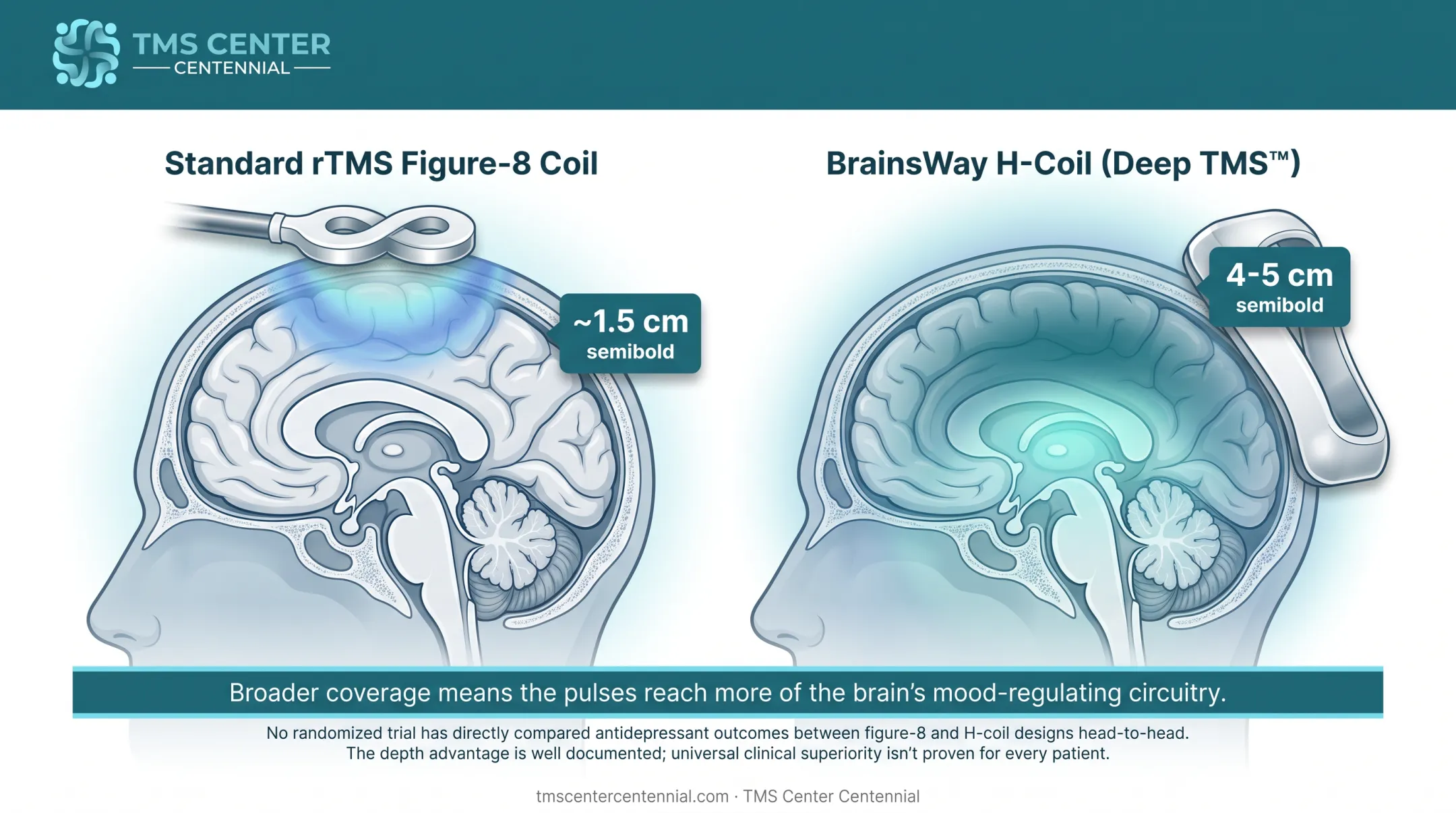 Deep TMS H-coil versus standard rTMS coil depth comparison diagram