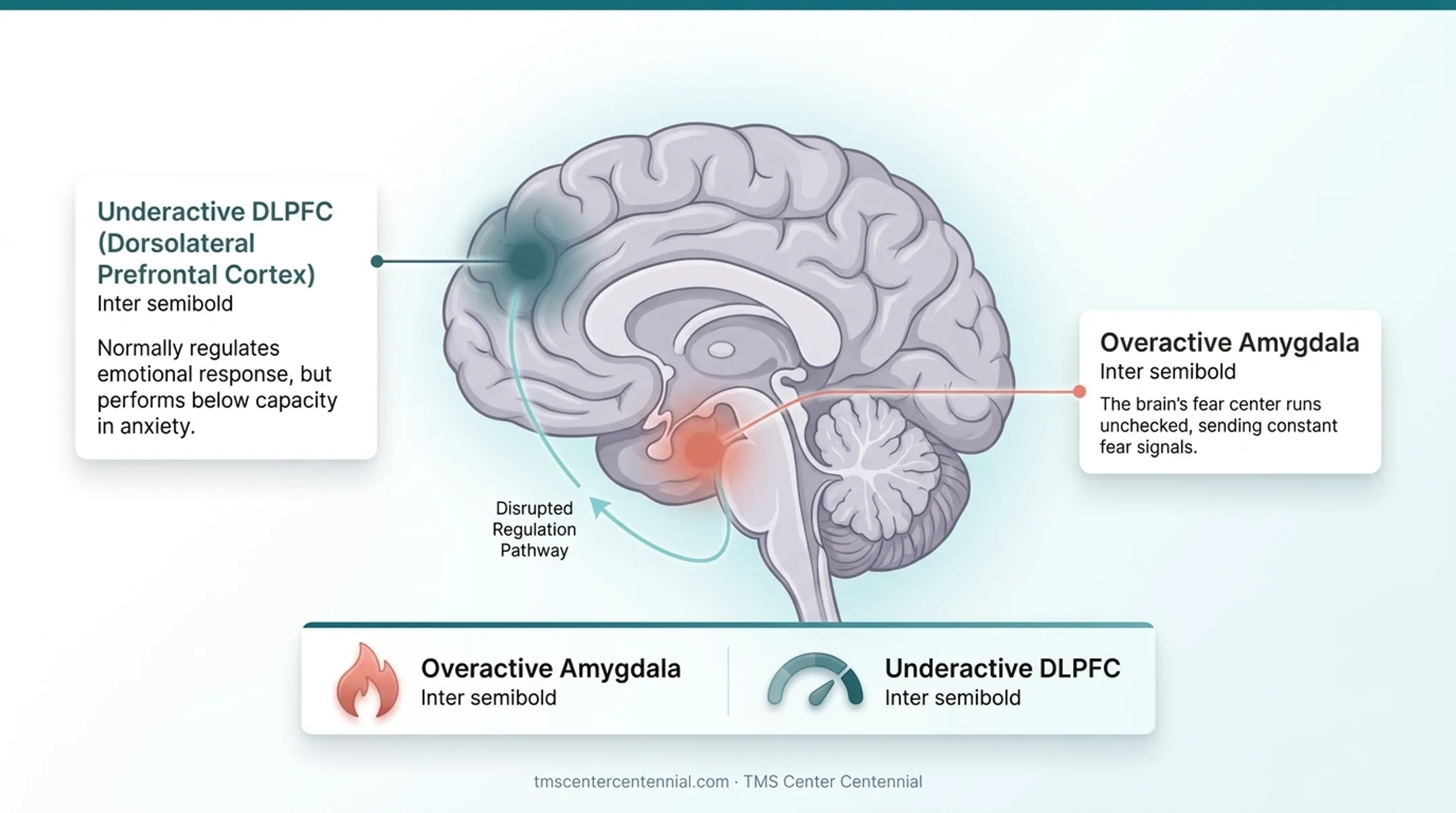 Brain diagram showing amygdala and prefrontal cortex anxiety circuit imbalance
