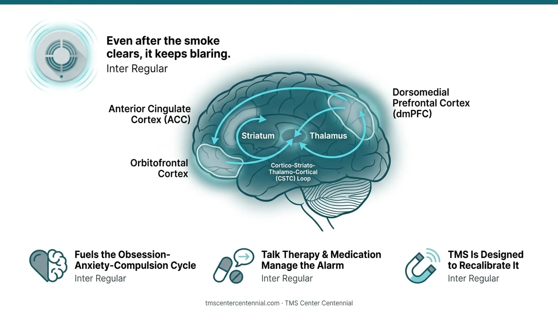 CSTC brain loop circuit diagram showing OCD hyperactive pathway