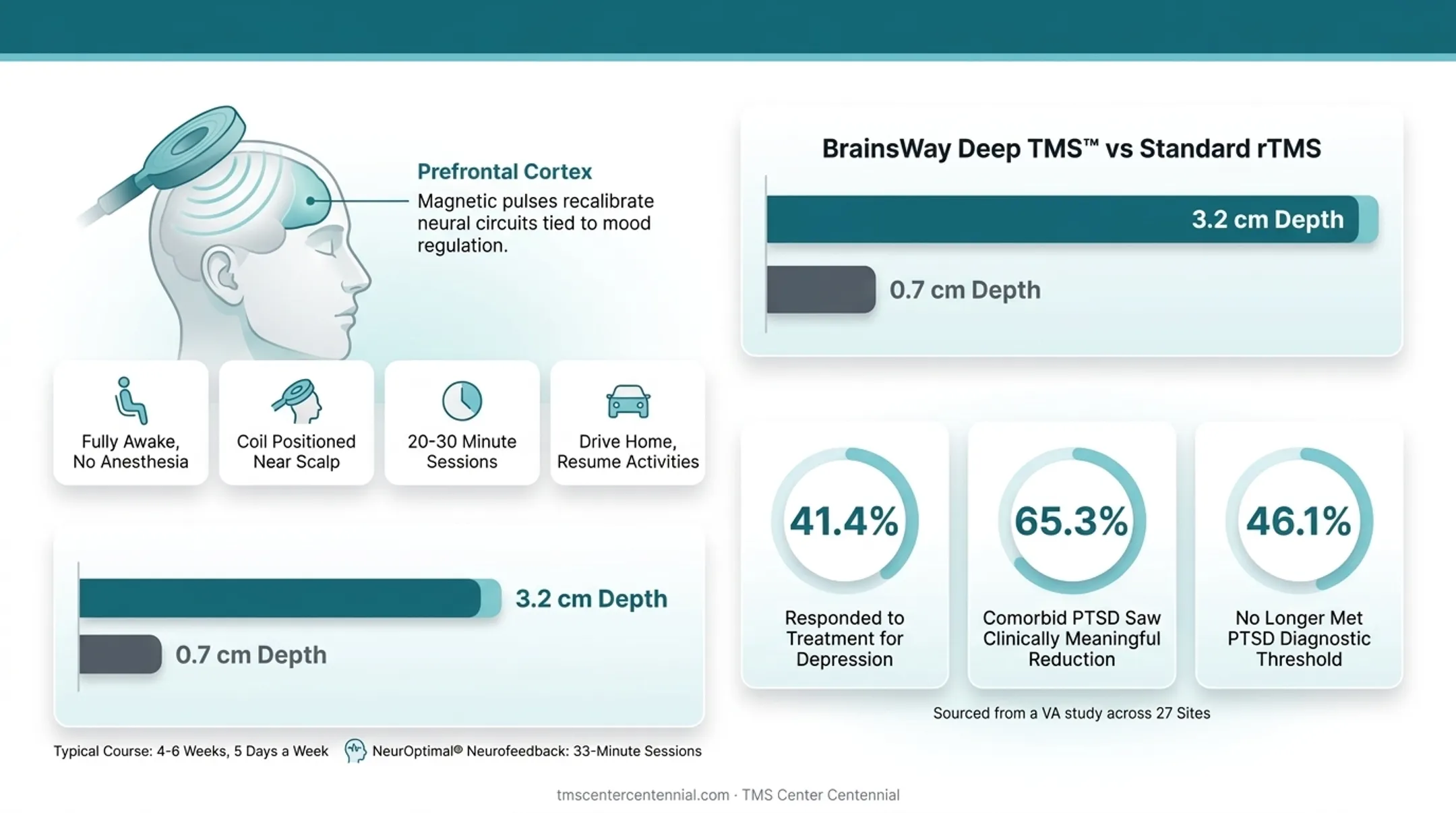 VA veteran TMS treatment outcomes for depression and PTSD statistics