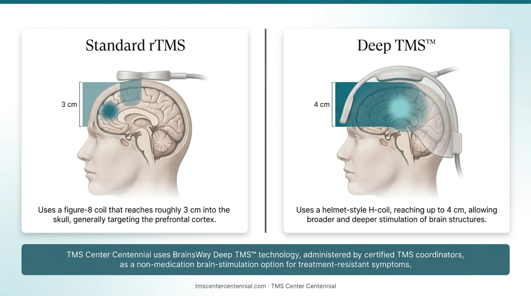 Standard rTMS versus Deep TMS coil depth and coverage comparison