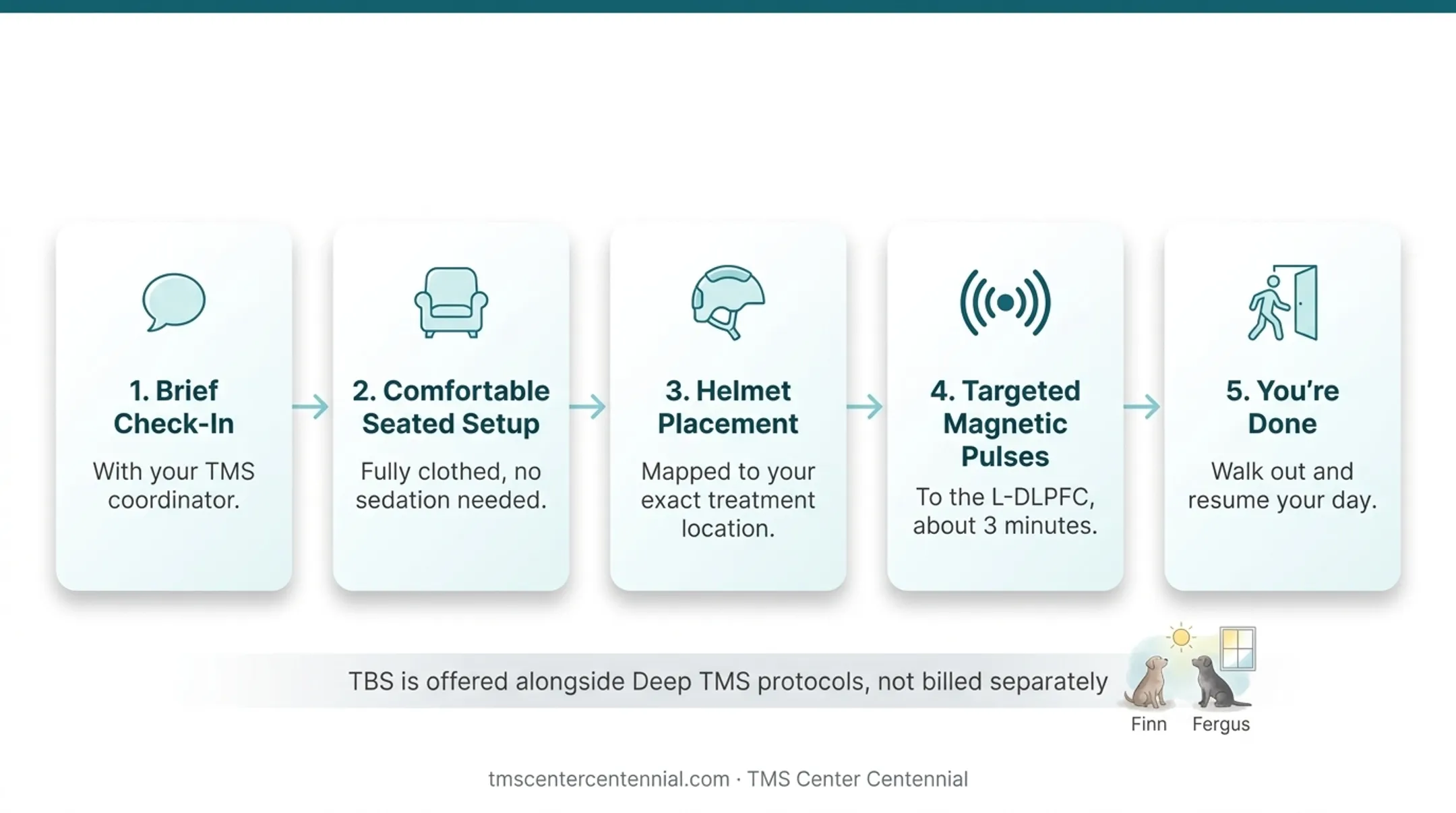 5-step theta burst stimulation treatment session process flow