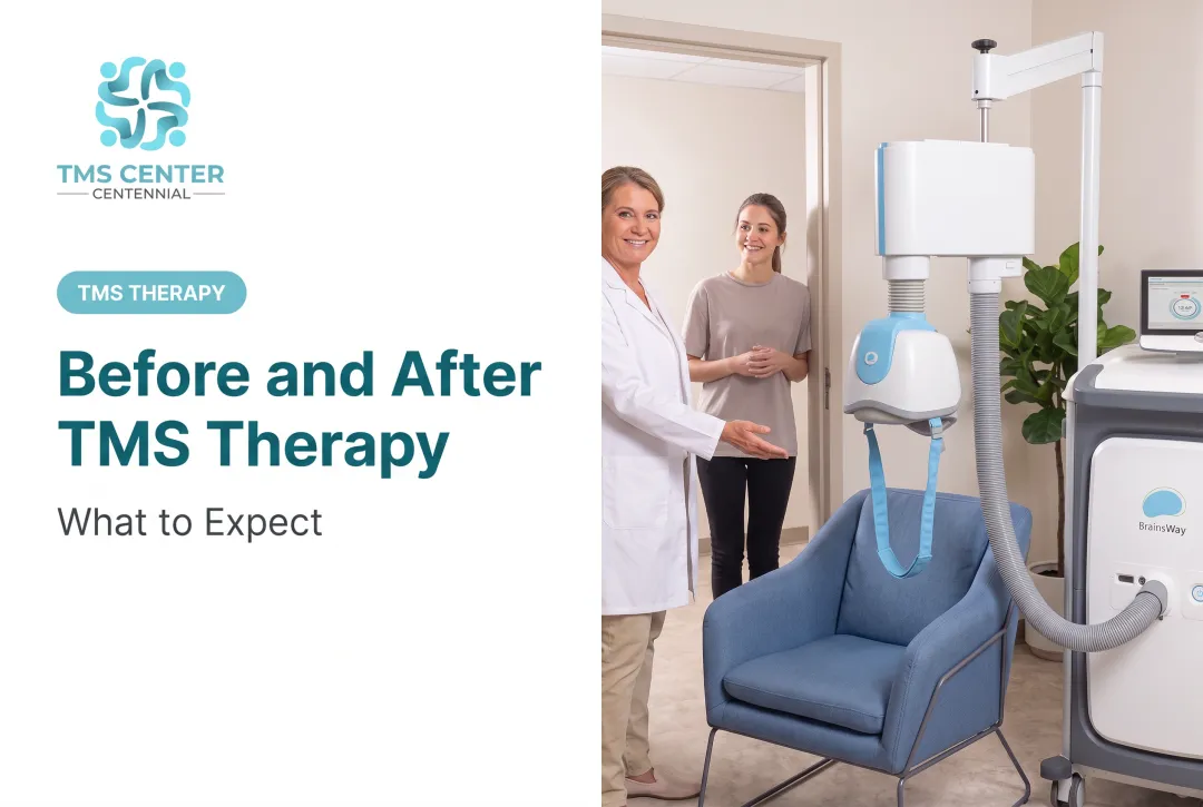 Before and After TMS Therapy: What to Expect