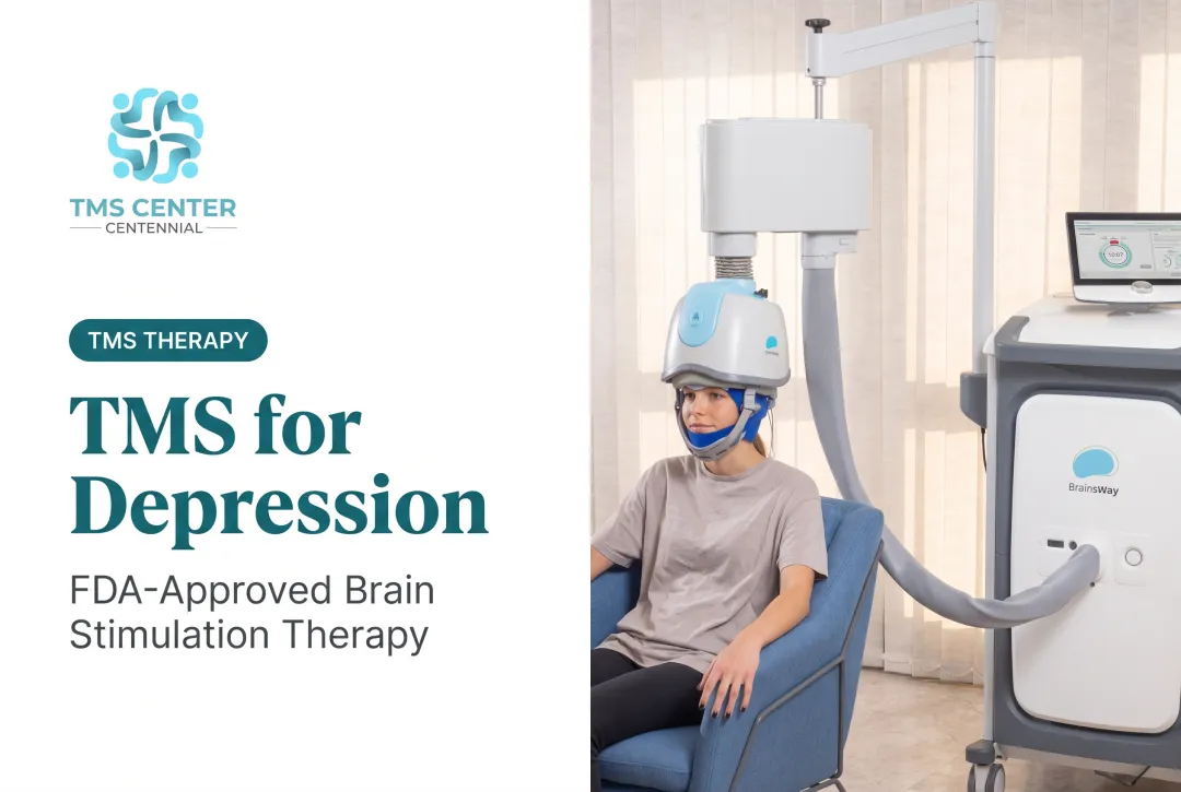 TMS for Depression