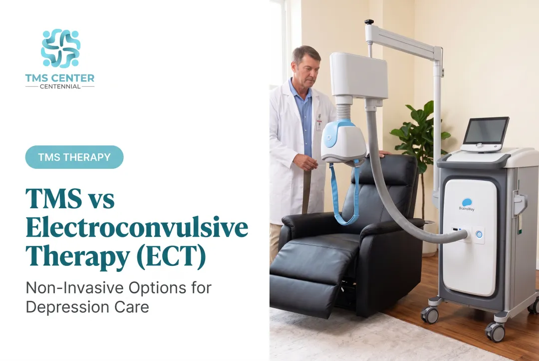 TMS vs Electroconvulsive Therapy (ECT)