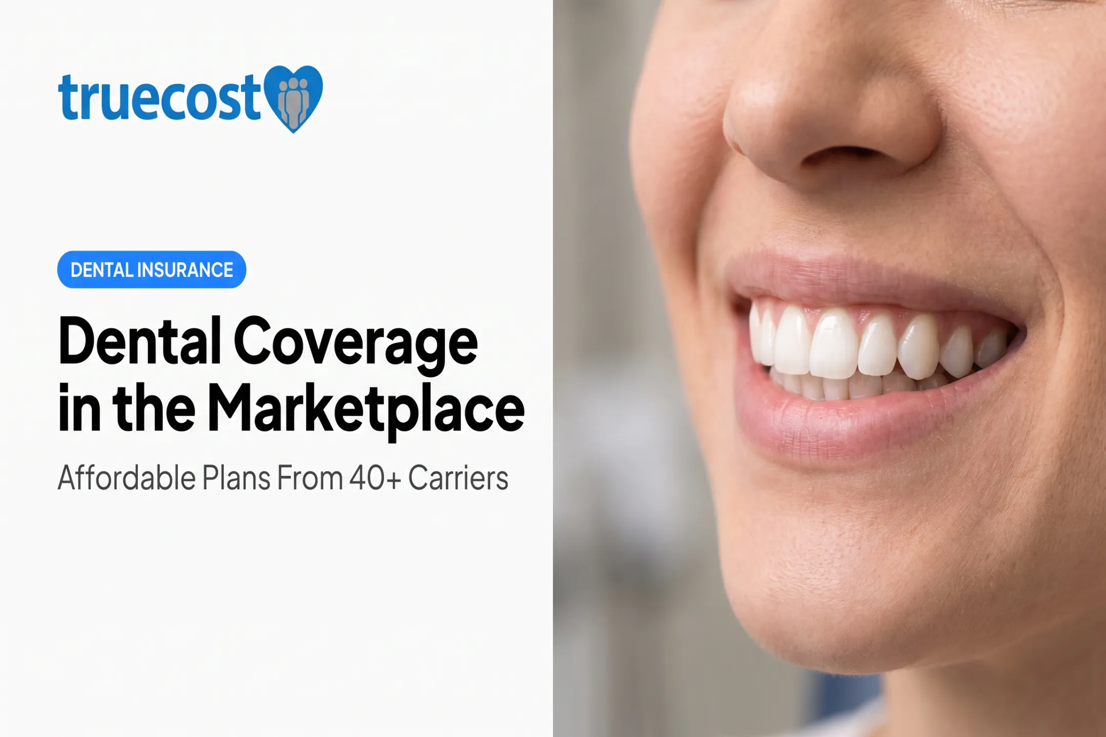 Dental Coverage in the Marketplace
