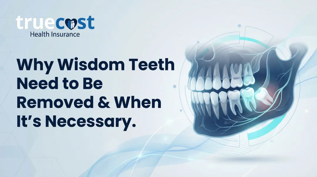 Cover image for Why Wisdom Teeth Need to Be Removed & When It’s Necessary