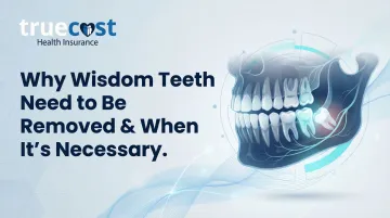 Cover image for Why Wisdom Teeth Need to Be Removed & When It’s Necessary
