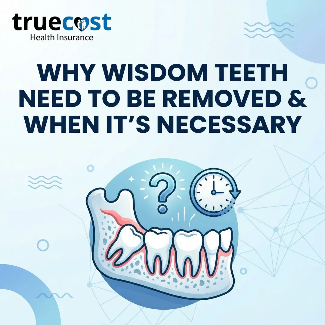 Why Wisdom Teeth Need to Be Removed & When It’s Necessary