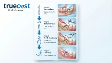 Infographic