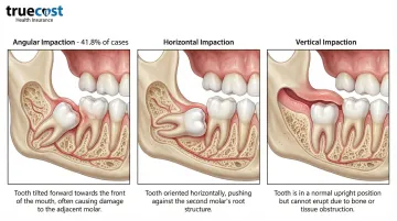 Infographic