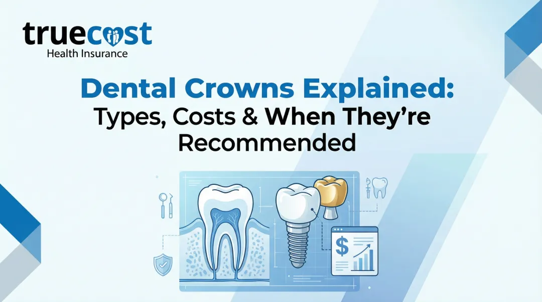 Cover image for Dental Crowns Explained: Types, Costs & When They’re Recommended