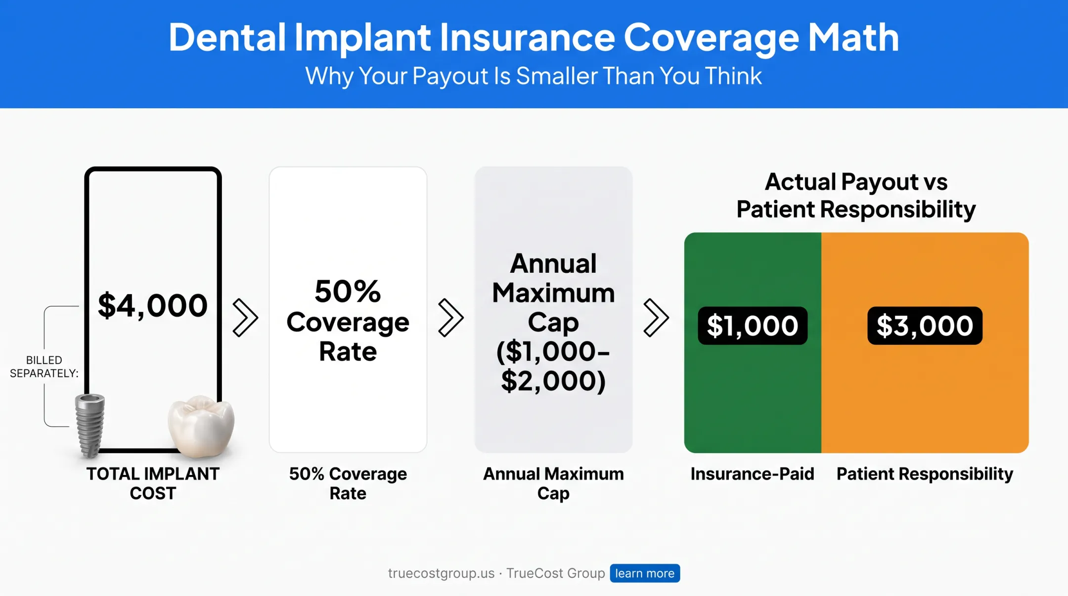 Dental insurance coverage breakdown for implant costs and annual maximums