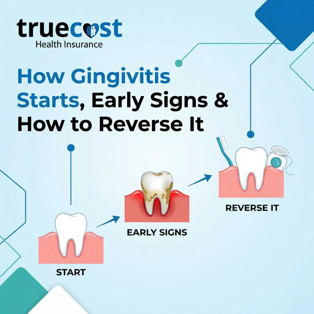 How Gingivitis Starts, Early Signs & How to Reverse It