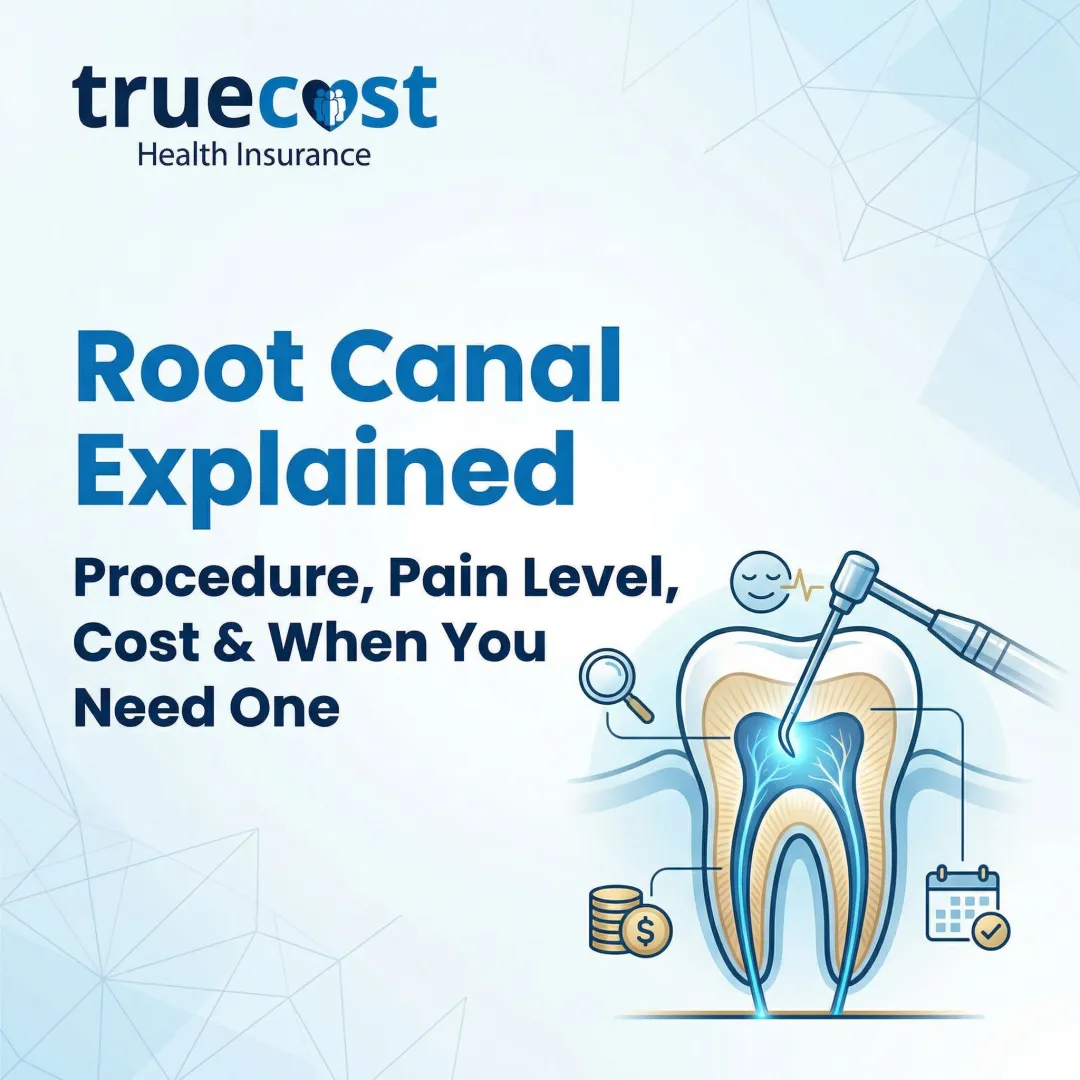 Root Canal Explained: Procedure, Pain Level, Cost & When You Need One