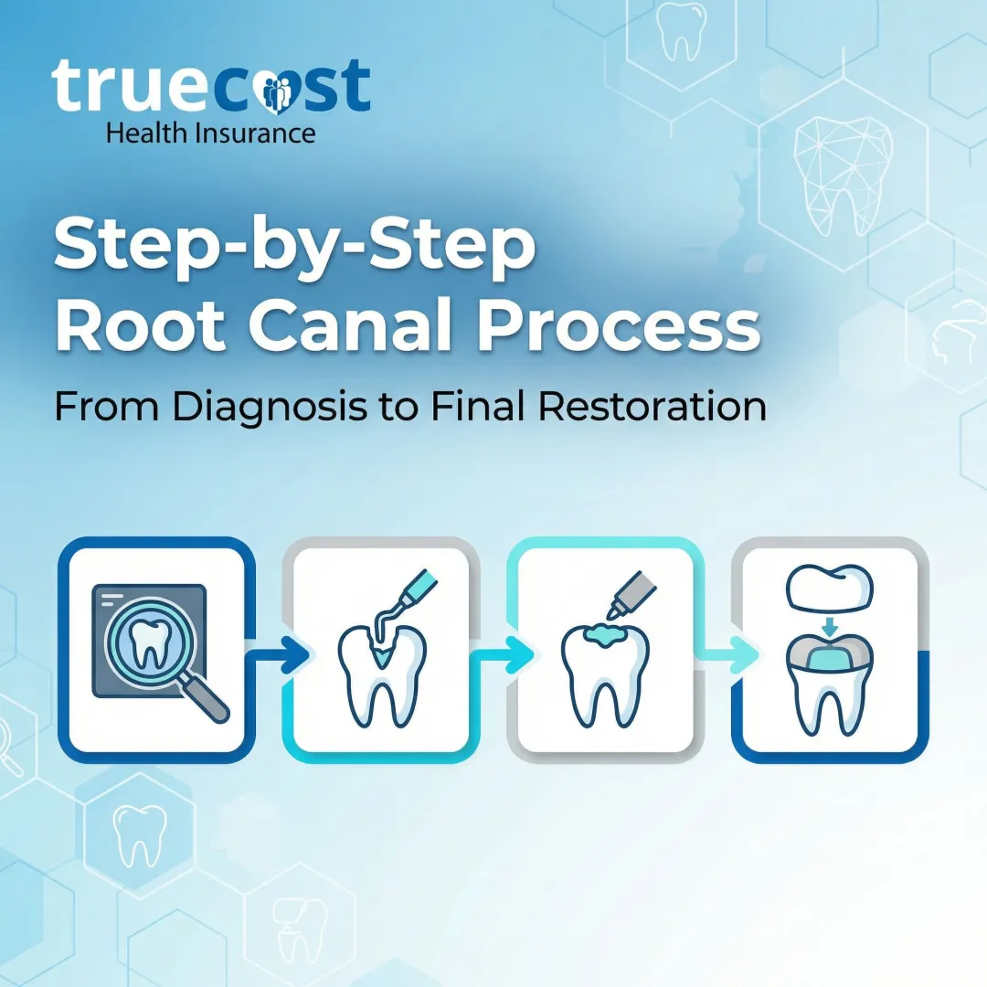 Step-by-Step Root Canal Process: From Diagnosis to Final Restoration