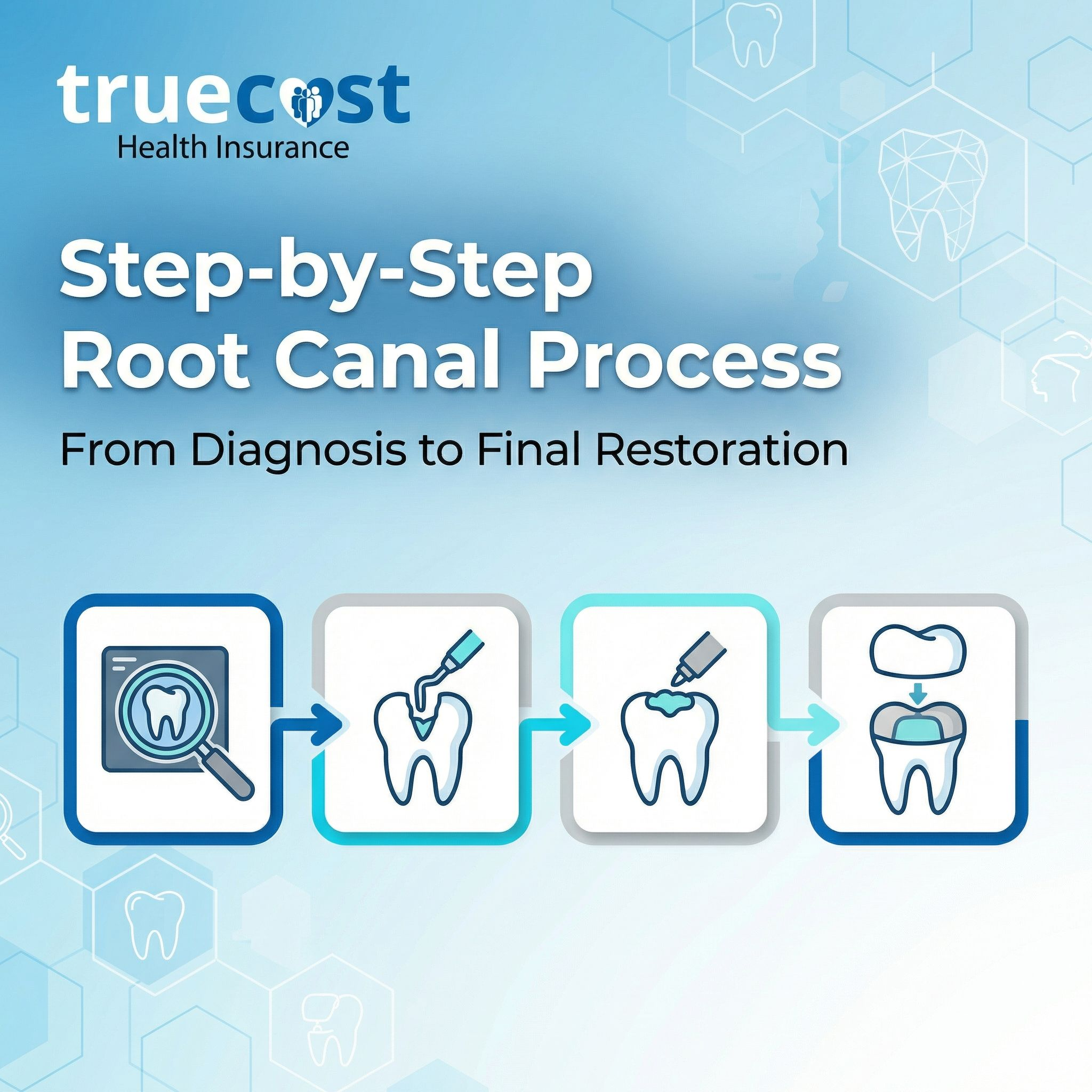 Step-by-Step Root Canal Process: From Diagnosis to Final Restoration