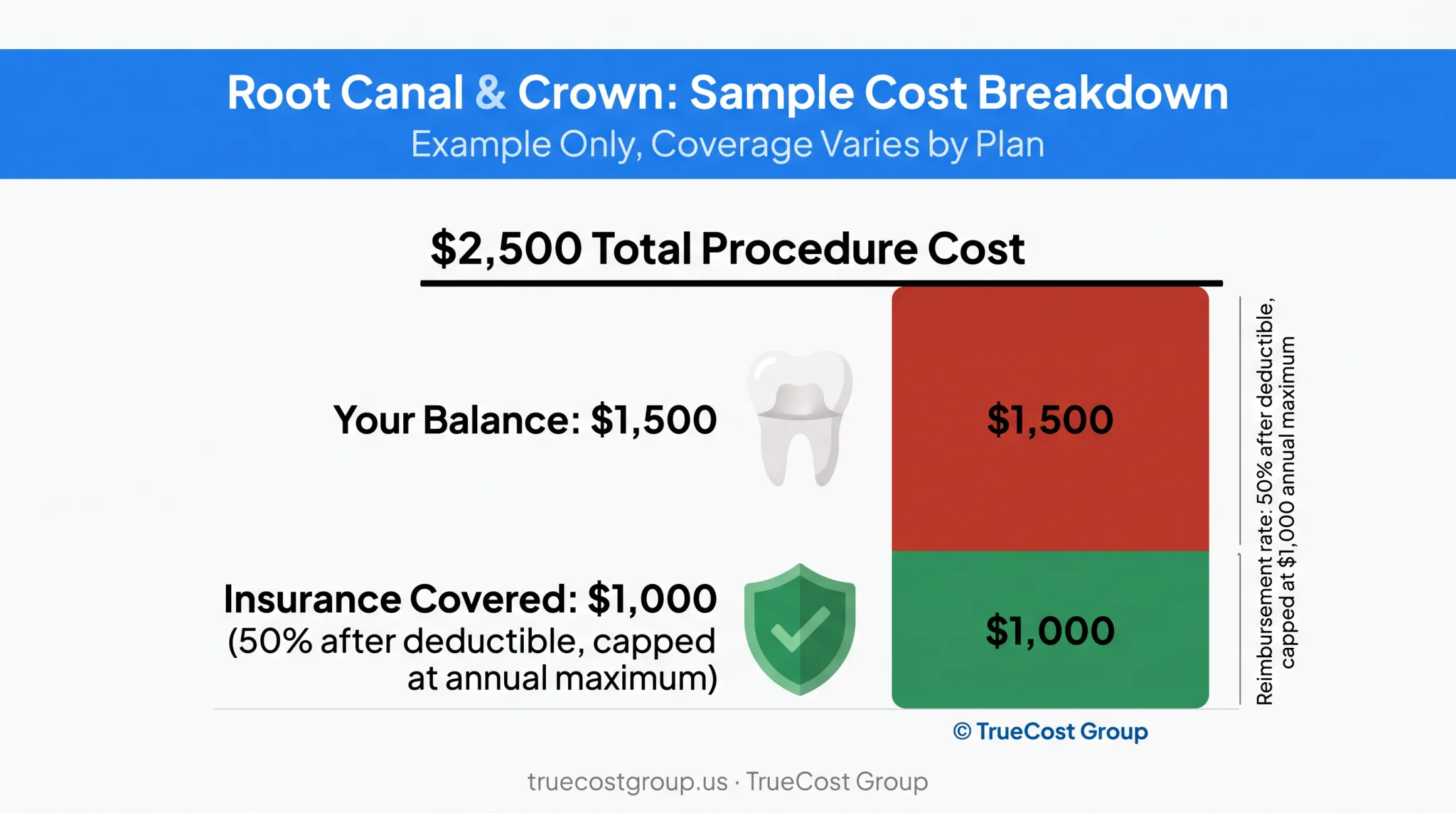 Root canal and crown cost breakdown with annual maximum cap example