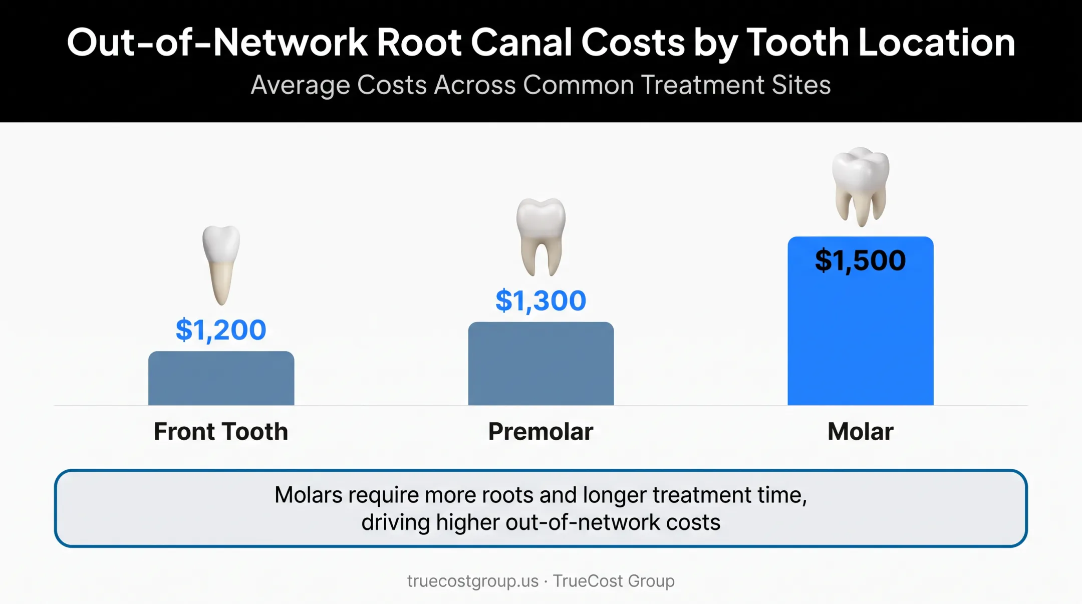 Root canal cost comparison by tooth type front premolar molar